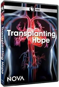 移植希望 PBS Nova Transplanting HOPE的海报