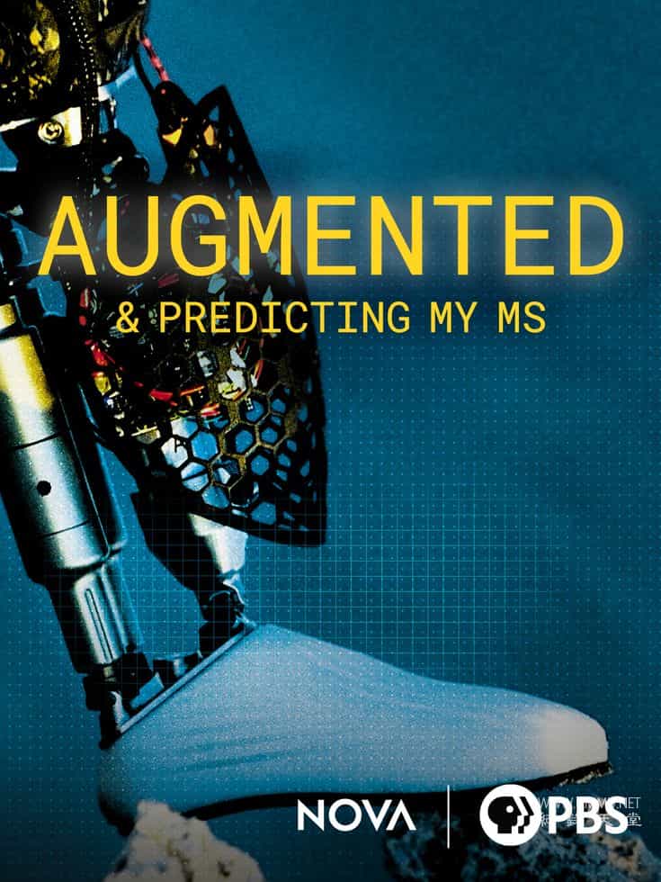 我的多发性硬化症增强与预测 Augmented & Predicting My MS的海报